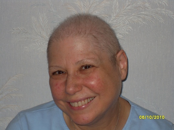 Bald Rose 